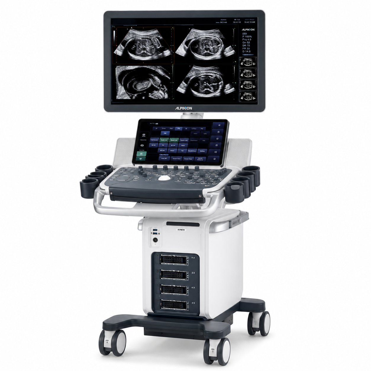 MEDDICATE MDX10 4D/5D Ultrasound
